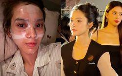Bà chủ resort miền Tây từng khiến Tiểu Vy "out nét" khi đứng cạnh nay gặp kiếp nạn nhan sắc