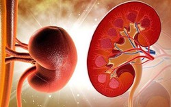 Người đàn ông phải cấp cứu vì suy thận cấp: Cảnh báo 1 kiểu uống nước nguy hiểm