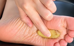 Trước khi đi ngủ, nhiều người có thói quen đắp gừng, hành vào lòng bàn chân để ngủ ngon: Chuyên gia nói 1 câu ai cũng bất ngờ