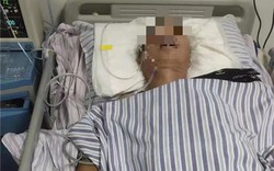 Người đàn ông 51 tuổi đang cười nói bỗng nhồi máu não, bác sĩ nói thẳng: 3 loại gia vị là "sát thủ"