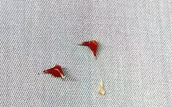 Bé 7 tháng tuổi suy hô hấp sau khi ăn cháo lươn