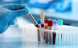 Một nhóm nghiên cứu Nhật Bản đã có khám phá đáng kinh ngạc trong máu của người sống trăm tuổi