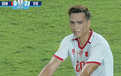 Xót xa khoảnh khắc Bùi Hoàng Việt Anh rách mí mắt, máu chảy ròng ở trận Việt Nam gặp Indonesia