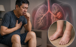 Bác sĩ cảnh báo, 4 BẤT THƯỜNG cảnh báo ung thư phổi: Nhiều người dễ bỏ qua vì tưởng chỉ là bệnh vặt