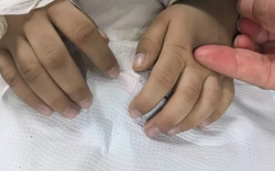 Bé 3 tuổi tím tái, bác sĩ phát hiện ngộ độc nitrit: 6 kiểu đồ ăn thừa cha mẹ nên lưu ý