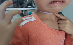 Mẹ trẻ chia sẻ phen "đứng tim" khi thấy con trai bị dây rút nhựa siết chặt cổ
