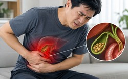 Bác sĩ chỉ 4 dấu hiệu cảnh báo sỏi mật, một dấu hiệu dễ nhận thấy sau bữa ăn