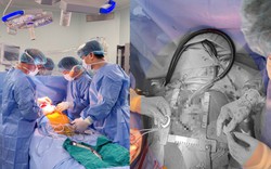 Lần đầu tiên tại Việt Nam: Người bệnh suy tim giai đoạn cuối được cấy ghép "trái tim cơ học" phù hợp