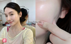 5 serum "made in Vietnam" làm sáng da, mờ thâm nám hiệu quả cho tuổi 35+