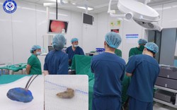 Bé gái 4 tuổi tiết dịch hôi vùng kín suốt 1 tháng, bác sĩ phát hiện 2 dị vật ở sâu bên trong