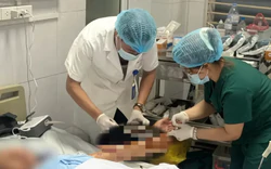 Chó nhà bất ngờ tấn công: Người gãy xương, người lóc da căng tay gân cơ 