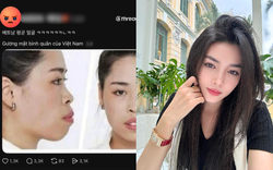 Người đẹp lột xác thành công nhờ "dao kéo" vướng lùm xùm liên quan đến miệt thị ngoại hình người Việt