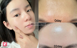 Vì sao nhiều người chuyển từ tẩy da chết dạng hạt sang loại nước?
