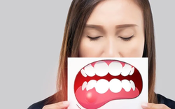 Uống cola khi đeo niềng răng trong suốt có được không? Bác sĩ: Cái giá phải trả quá cao! 3 lời khuyên để an toàn cho răng khi ăn tiệc