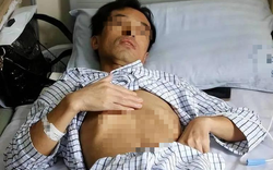 Người đàn ông 53 tuổi nhận "án tử" ung thư gan, bác sĩ tức giận: Đừng làm việc này quá 3 lần 1 tháng!