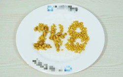 Lấy ra 248 viên sỏi từ túi mật chàng trai 26 tuổi có sở thích ăn uống "vạn người mê"