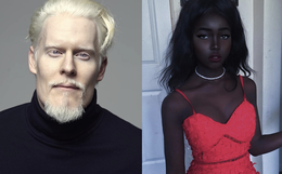 8 người sinh ra với màu da lạ kỳ chẳng giống ai nhưng lại đẹp đến mê hoặc: Từ "búp bê Barbie đen" đến "cô gái bạch tạng đẹp nhất thế giới"