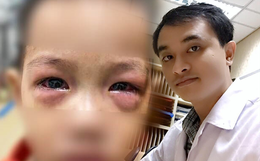 Bệnh đau mắt đỏ lây lan cả nước, bác sĩ đưa những cách hạn chế nhiễm bệnh trong giai đoạn này