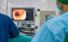 Ngày càng nhiều người còn trẻ đã khổ sở vì ung thư đại tràng, bác sĩ nghiêm mặt: 3 thứ này ăn càng ít càng tốt!