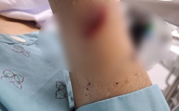 2 phụ nữ chém nhau bị thương nặng vì ghen tuông ở Thái Bình: Hé lộ tình trạng hôn nhân phức tạp