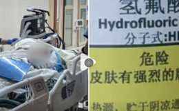 Giẫm phải ‘nước hòa tan xương’ khi đi dạo, người phụ nữ chết sau 5 ngày