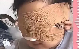 Bé gái 6 tuổi mất cả 2 mắt vì thứ nhiều bố mẹ vẫn cho con chơi mỗi ngày