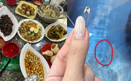 Đi ăn ốc, cô gái nuốt cả chiếc kim băng đang mở vào bụng, phải mổ cấp cứu 6 tiếng, tốn 70 triệu