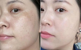 Làm 6 việc này trước khi đi ngủ, làn da của tôi như “tái sinh” về năm 20