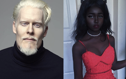 8 người sinh ra với màu da lạ kỳ chẳng giống ai nhưng lại đẹp đến mê hoặc: Từ "búp bê Barbie đen" đến "cô gái bạch tạng đẹp nhất thế giới"