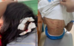 Bé gái lớp 5 nghi bị bố dượng bạo hành đã mở cửa sổ cầu cứu hàng xóm: Thêm loạt chi tiết gây phẫn nộ