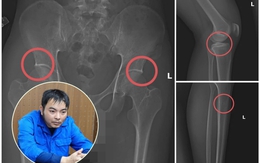 Nóng: Cựu cán bộ y tế cầm đầu đường dây tự đục vỡ xương khớp để lấy bảo hiểm