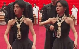 Cam thường lộ vai dị dạng của mỹ nhân 4000 năm có một