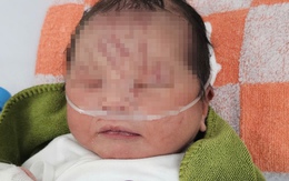 NÓNG: Một trẻ sơ sinh nghi bị "chôn sống" tại vườn cao su