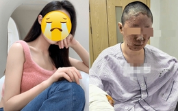 Sốc: Người mẫu 27 tuổi bỏng nặng, mặt biến dạng sau vụ nổ khí gas kinh hoàng