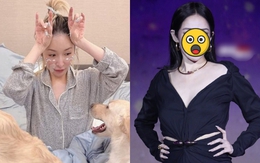 Sốc nặng với "gương mặt rắn" biến dạng của nữ ca sĩ hạng A sau vụ bị chó cắn đến hủy dung