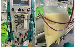 Cô gái Phú Thọ chỉ nặng 45kg nhưng mỡ máu cao gấp 37 lần, hình ảnh lọc mỡ máu trắng như sữa gây sốc