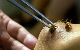 Vụ mẹ tử vong, con 3 tuổi nhập viện do bị ong vò vẽ đốt: Người mẹ lấy thân che chắn cho con, chịu đến 200 vết đốt