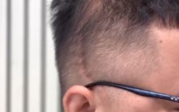 Theo tôi, đây là chi tiết ĐÁNG SỢ nhất trong vụ Trung tâm Hải Hà bạo hành trẻ!