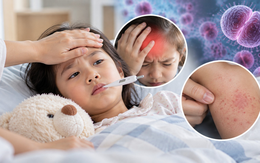 4 học sinh mắc não mô cầu, 1 em tử vong: Căn bệnh có thể diễn biến nguy kịch chỉ sau vài giờ, cha mẹ cần nhận biết dấu hiệu này