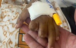Bé trai 10 tuổi sáng đau đầu, chiều hôn mê và xuất hiện tử ban vì não mô cầu: "Tối đó chuyển lên Nhi Đồng Thành Phố, nhưng em không qua khỏi"
