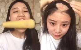 Cuộc sống sang chảnh hiện tại của “cô gái bị hói một mảng đầu vì ăn ngô bằng khoan” 10 năm trước