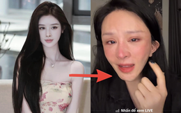 Xôn xao vụ cô gái hút mỡ hết 70 triệu nhận lại mặt biến dạng, nửa đêm "phốt" bác sĩ thẩm mỹ: Phía bác sĩ nói gì?