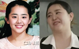 Moon Geun Young bị hoại tử và phát tướng mất kiểm soát do bệnh quái ác, bỏ lỡ giai đoạn vàng để điều trị