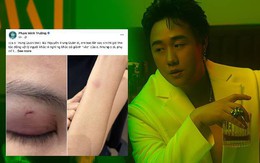 Nóng: Công an vào cuộc vụ ca sĩ Trung Quân Idol bị tố hành hung phụ nữ ở TPHCM