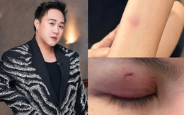 Mới nhất drama hành hung nữ bác sĩ: Trung Quân Idol thông báo ngưng hoạt động rồi xoá post sau 10 phút