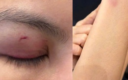 Luật sư nhận định vụ ca sĩ Trung Quân Idol bị tố đánh phụ nữ