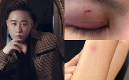 Ca sĩ Trung Quân Idol bị tố hành hung phụ nữ: Luật sư nói gì về trách nhiệm pháp lý?