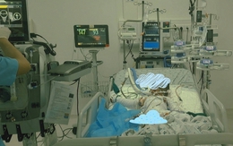 Bé trai 4 tuổi mất cả cha lẫn mẹ sau vụ cháy kinh hoàng, đang giành giật sự sống với cơ thể bị bỏng 90%