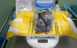 Ca mổ lấy thai đặc biệt: Đón bé 3,3kg chào đời và bóc tách thành công 9 khối u xơ tử cung