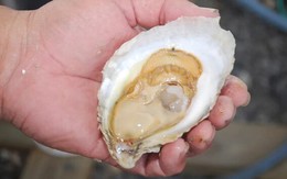 Người đàn ông 50 tuổi bị suy thận cấp sau khi ăn hàu sống